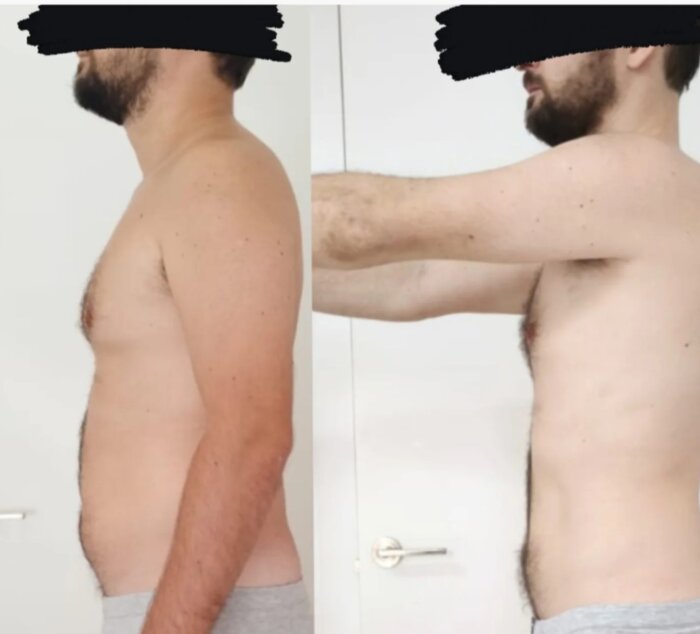 Transformación física de un cliente: antes y después (caso 12)